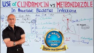 Clindamycin vs Metronidazole  Anaerobic Infection  Pharmacology💊 [upl. by Yenahteb]