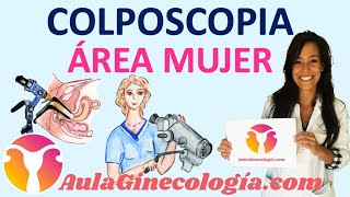 COLPOSCOPIA QUÉ ES CÓMO se realiza COMPLICACIONES y CUIDADOS  Ginecología y Obstetricia [upl. by Arlan]