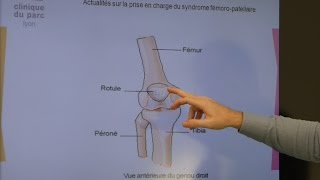 Le syndrome fémoro patellaire Dr Olivier Rajon [upl. by Noseyt379]