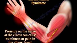 Cubital Tunnel Syndrome Ulnar Nerve Entrapment  Everything You Need To Know  Dr Nabil Ebraheim [upl. by Nohsreg]