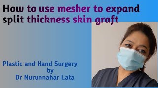 How to use mesher to expand split thickness skin graft [upl. by Acined876]