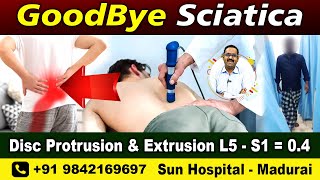 Sciatica  L4 L5  L5 S1 disc bulge best exercises  Rehabilitation for pain relief  Sun Hospital [upl. by Arawaj950]