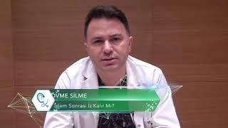 Dövme Silme İşlemi Sonrası İz Kalır Mı  Dr estethica [upl. by Eilram]