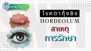 โรคตากุ้งยิง Hordeolum [upl. by Drofub371]