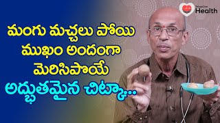 Melasma  మంగు మచ్చలు పోయి ముఖం అందంగా Dr Chittibhotla Madhusudana Sarma  TeluguOne Health [upl. by Dhu577]