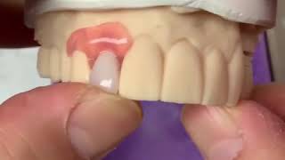 3D printed Mini Dentures [upl. by Martinson]