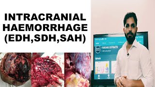 INTRACRANIAL HAEMORRHAGE EDHSDHSAH [upl. by Xila]