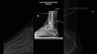 Anatomía radiológica de tobillo [upl. by Lela]