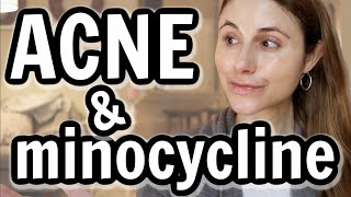 Minocycline versus doxycycline for acne Dr Dray [upl. by Mullins]