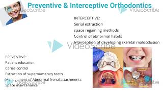 Preventive and interceptive orthodontics [upl. by Bergquist]