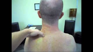 Neck Strain fixed with two Manual Therapy treatments [upl. by Ydnarb]