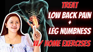 Treating Lumbar Spondylosis with Home Exercises  Doc Cherry [upl. by Doloritas972]