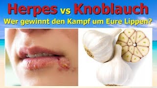 Herpes gegen Knoblauch  wer gewinnt den Kampf um Eure Lippen [upl. by Camp]