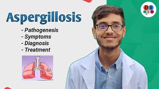 Aspergillus fumigatus  Aspergillosis  Aspergillioma  Microbiology bangla lecture [upl. by Carlos46]