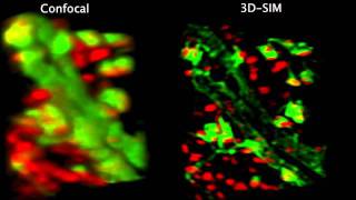 Confocal vs 3D structured illumination [upl. by Dur]