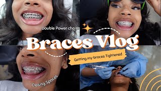 COME WITH ME TO GET MY BRACES TIGHTENED  BRACES VLOG 😁✨ [upl. by Nirehtak]