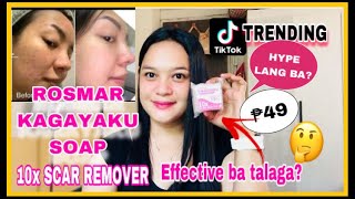 MY HONEST REVIEW OF ROSMAR KAGAYAKU SOAP  Miss Bessie [upl. by Obediah]