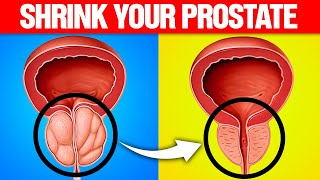 Top 10 Vitamins to SHRINK an Enlarged Prostate [upl. by Sesilu253]