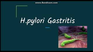 Helicobacter pylori gastritis Pathogenesis and morphology [upl. by Niroc]