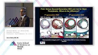 Evolution of Dual Antiplatelet Therapy After Coronary Stent Implantation From STARS to TWILIGHT [upl. by Ignatius]