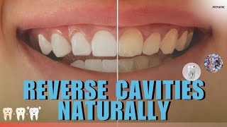 How To Reverse Cavities And Heal Tooth Decay Naturally At Home [upl. by Netaf]