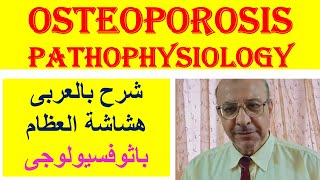 Osteoporosis Pathophysiology شرح بالعربى هشاشة العظام باثوفسيولوجى [upl. by Adalheid]