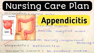 Nursing Care Plan on Appendicitis Nursing Diagnosis Nursing process [upl. by Germann110]