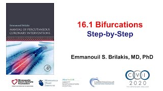 161 Bifurcation PCI stepbystep  Manual of PCI [upl. by Hackett471]