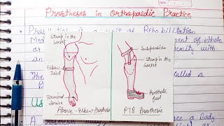 Prosthesis in Orthopaedic Practice  uses parts of prosthesis [upl. by Brooke879]