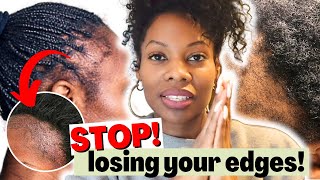 Grow Your EDGES BACK Fast Thicker With This Regimen  How To Treat Traction Alopecia [upl. by Eliga348]