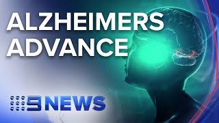 New medical approach tackling Alzheimers disease  Nine News Australia [upl. by Loesceke]