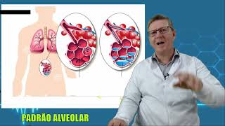 CURSO DE RADIOLOGIA PADRÃO ALVEOLAR [upl. by Brott]