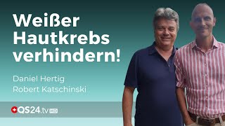 Weißer Hautkrebs muss nicht immer operiert werden  Alternativmedizin  QS24 Gesundheitsfernsehen [upl. by Selrac727]