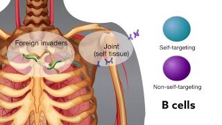 Chronic bacterial infection activates autoreactive B cells [upl. by Adam205]