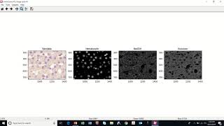 Chromogenic Assay CellProfiler Demo [upl. by Tedi]