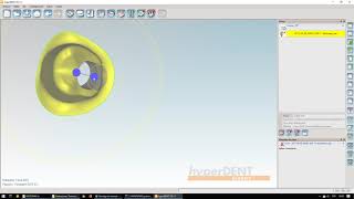 HYPERDENT  6  Interfase angulada con metadatos [upl. by Ellen950]