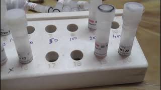 ODD methodOuchterlony Double diffusion practical method [upl. by Eceirahs]