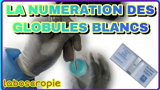 la numération des globules blancs [upl. by Nealy875]