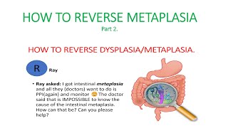 Metaplasia dysplasia How to reverse dysplasia metaplasia Causes of metaplasia [upl. by Elfreda]