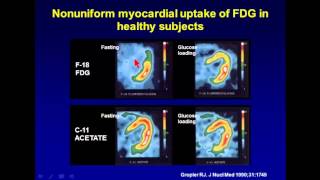 Day 1  Cardiovascular1  02 PET CT in Evaluating Cardiac Viability 1 [upl. by Ferguson659]