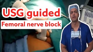 USG GUIDED FEMORAL NERVE BLOCK  Explained with Video  How to do it  Anatomy amp Landmarks [upl. by Aniretake]