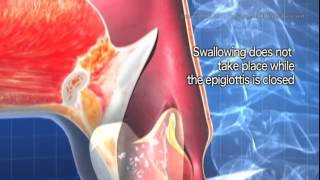 Dysphagia video [upl. by Elleinaj710]