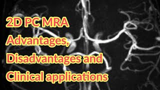 2D Phase contrast MRA Advantages Disadvantages and clinical applications [upl. by Eiram259]