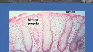 T CellTargeting in Inflammatory Bowel Disease [upl. by Ethelind]