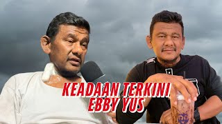 Dialisis 3 kali sehari Ebby Yus perlu pemindahan buah pinggang [upl. by Giarc]