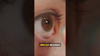 What to Do if a Contact Lens Gets Stuck in Your Eye facts shortsfeed shortsvideo shortvideo [upl. by Arreip]