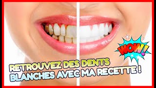 astuce maison pour avoir des dents dun blanc nacré [upl. by Petronilla627]