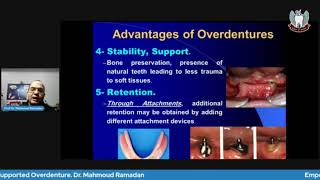 Tooth Supported Overdenture Part 1 Advantages Disadvantages Indications amp Contraindications [upl. by Nyral]