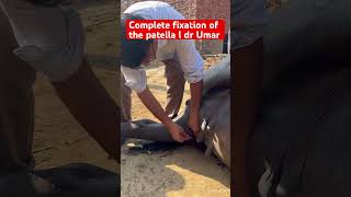 Complete fixation of the patella l dr Umar khan [upl. by Inava]