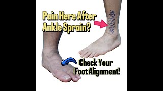 After Ankle Sprain and Surgery Check Your Foot Alignment [upl. by Hendon47]